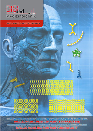 Maxillo Facial Titan Knochenplatten und Schrauben im Gesichtsbereich Maxillo Facial Titan Knochenplatten und Schrauben im Gesichtsbereich
